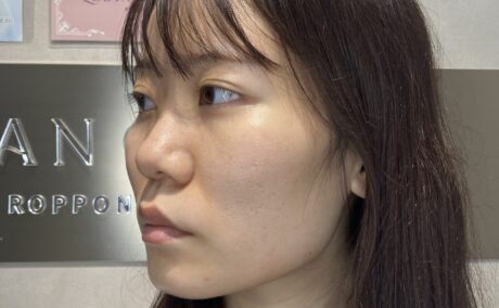 After