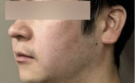 After